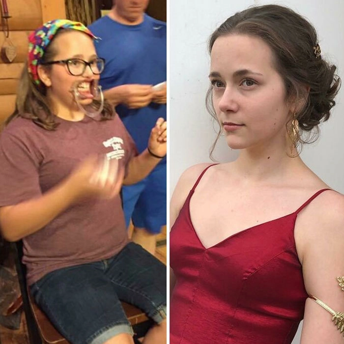 “Когда половое созревание наступает очень неожиданно”. “Когда половое созревание наступает очень неожиданно”.